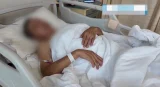 Bệnh nhân được đưa đến bệnh viện sau hai ngày liên tục giác hơi tại nhà. Ảnh: Jingshi Zhibo