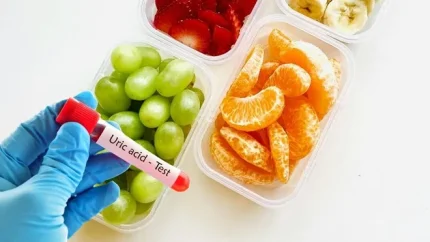Người có axit uric cao nên ăn các loại trái cây có chỉ số đường huyết thấp. Ảnh đồ hoạ: Hương Sơn/ Có sử dụng AI